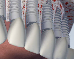 teeth diagram