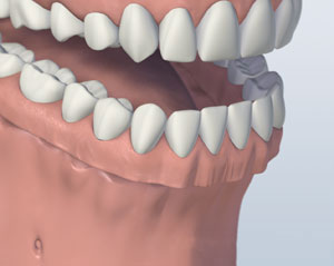 teeth diagram