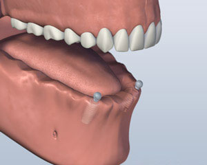 teeth diagram