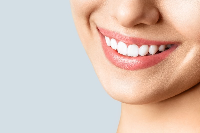 Beautiful female smile after teeth whitening procedure. 