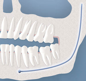 teeth diagram