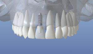 teeth diagram