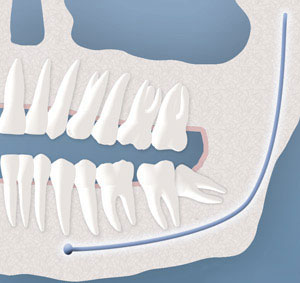 teeth diagram