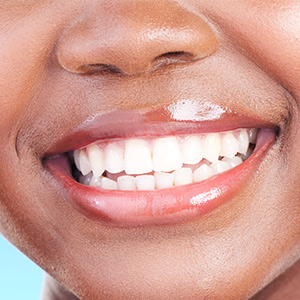 The closeup of a woman’s wide, white smile.