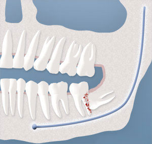 teeth diagram