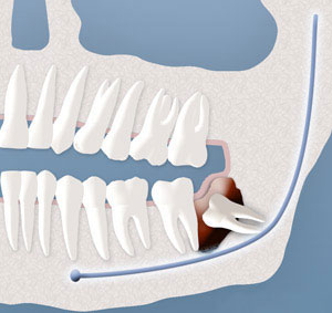 teeth diagram