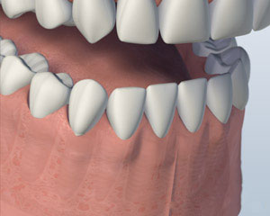 teeth diagram