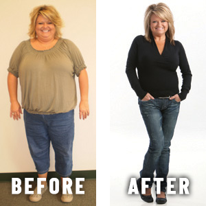 Before-and-after weight loss photos of a woman.