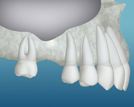 teeth diagram