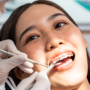 A dentist examines a woman’s mouth with braces using dental tools.