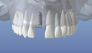 teeth diagram