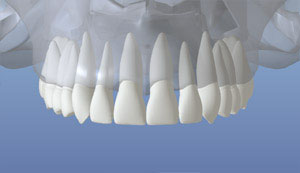 teeth diagram