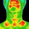 Thyroid thermography scan.