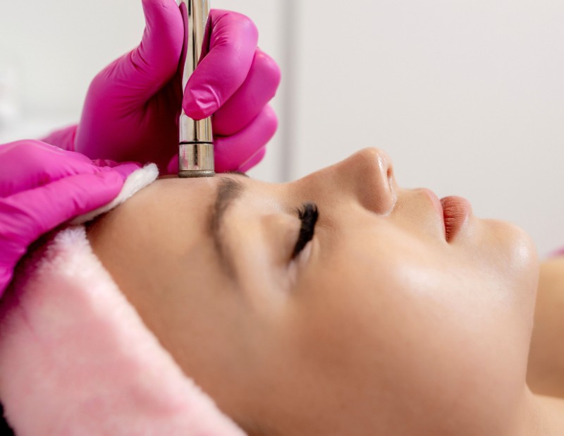 Microdermabrasion