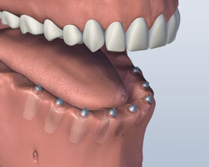 teeth diagram