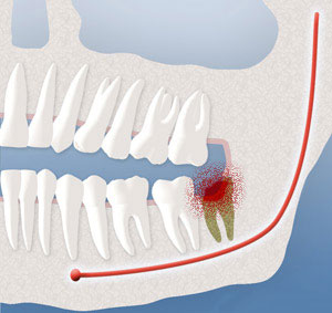 teeth diagram