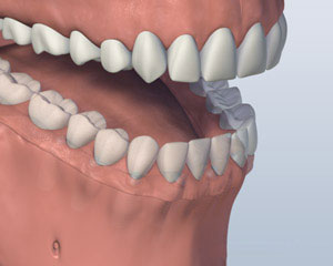 teeth diagram