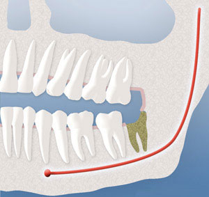 teeth diagram