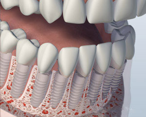 teeth diagram