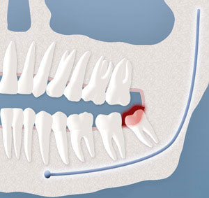 teeth diagram