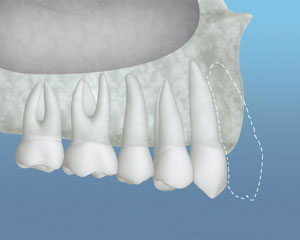 teeth diagram