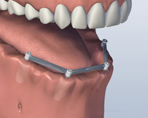 teeth diagram