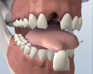 teeth diagram