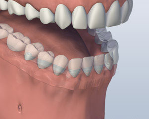 teeth diagram