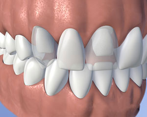 teeth diagram