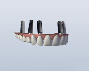 teeth diagram