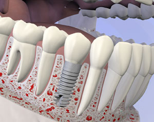 teeth diagram