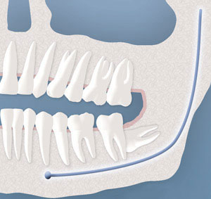 teeth diagram