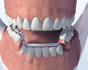 teeth diagram