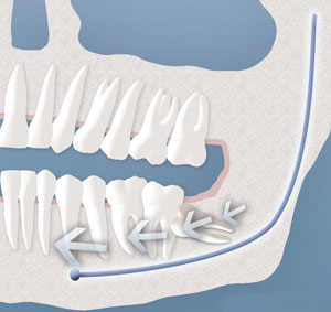 teeth diagram