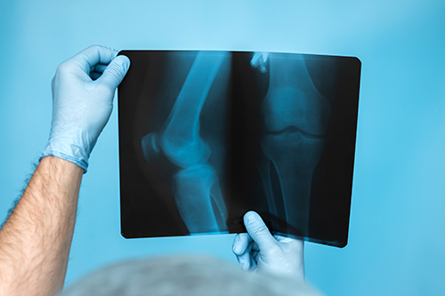 Orthopedic Doctor/Surgeon