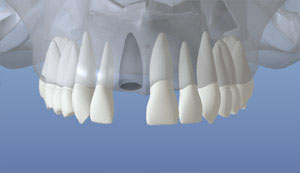 teeth diagram