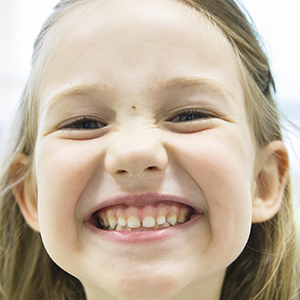 A young child smiles to show off her teeth.