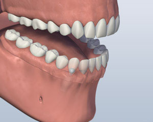 teeth diagram