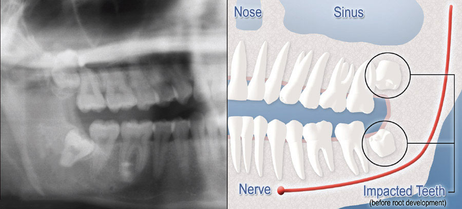 Teeth diagram