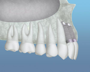 teeth diagram