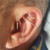 Acupuncture needles in a client's ear.