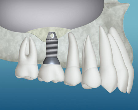 teeth diagram